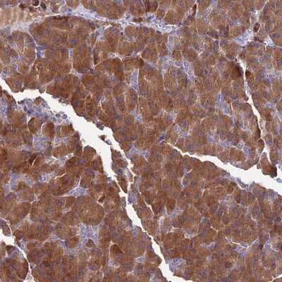 Immunohistochemistry-Paraffin: COMMD10 Antibody [NBP1-91801]