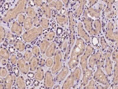 Immunohistochemistry-Paraffin: COMMD10 Antibody [NBP2-97236]