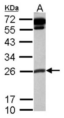 Western Blot: COMMD10 Antibody [NBP2-15949]