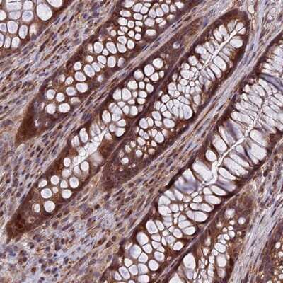 Immunohistochemistry-Paraffin: COMMD2 Antibody [NBP1-91802]