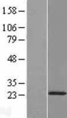 Western Blot: COMMD2 Overexpression Lysate [NBL1-09367]