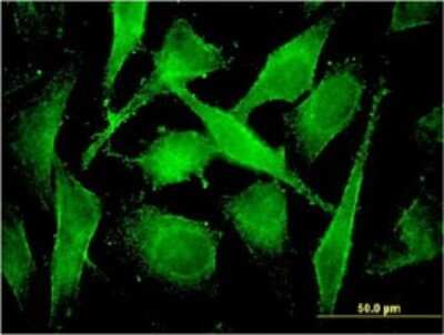 Immunocytochemistry/ Immunofluorescence: COMMD3 Antibody (2E2) [H00023412-M01]