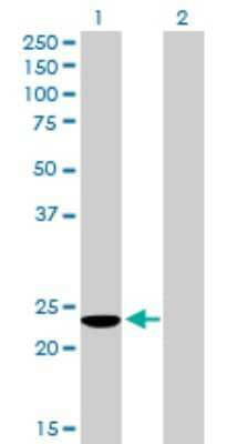 Western Blot: COMMD3 Antibody [H00023412-B01P]