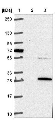 Western Blot: COMMD3 Antibody [NBP1-88519]