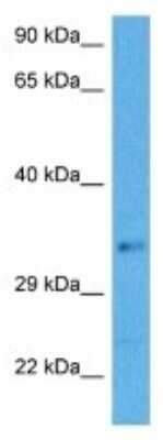 Western Blot: COMMD3-BMI1 Antibody [NBP3-10063]