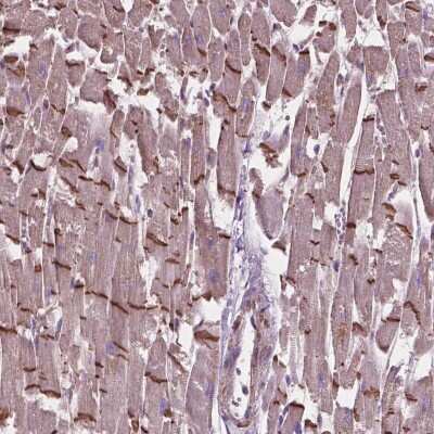 Immunohistochemistry-Paraffin: COMMD4 Antibody [NBP2-49500]