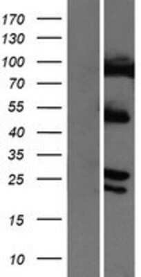 Western Blot: COMMD4 Overexpression Lysate [NBP2-06911]