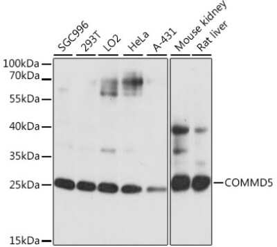 Western Blot: COMMD5 AntibodyAzide and BSA Free [NBP2-92325]