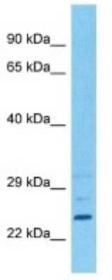 Western Blot: COMMD5 Antibody [NBP3-10847]