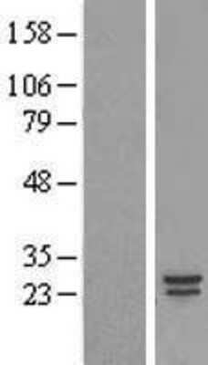 Western Blot: COMMD5 Overexpression Lysate [NBP2-09279]