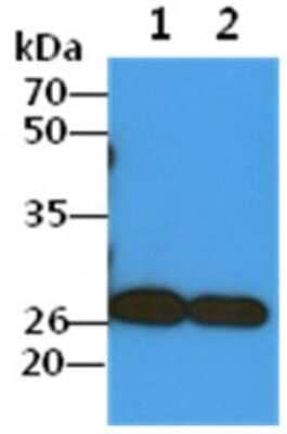 Western Blot: COMMD7 Antibody (49B5)BSA Free [NBP2-59423]