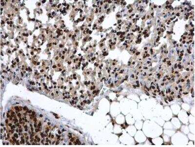 Immunohistochemistry-Paraffin: COMMD7 Antibody [NBP1-31697]