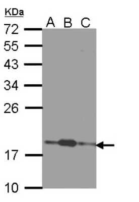 Western Blot: COMMD7 Antibody [NBP1-31697]