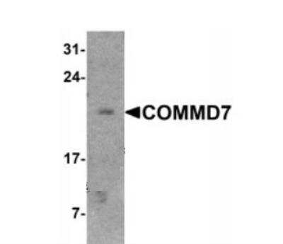 Western Blot: COMMD7 AntibodyBSA Free [NBP2-42124]