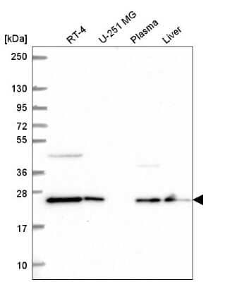 Western Blot: COMMD7 Antibody [NBP2-58399]