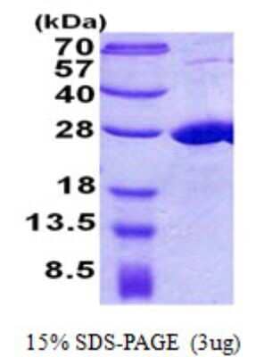 SDS-PAGE: Recombinant Human COMMD7 His Protein [NBP2-22794]