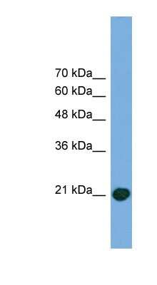 Western Blot: COMMD8 Antibody [NBP1-79661]