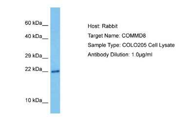 Western Blot: COMMD8 Antibody [NBP2-84716]