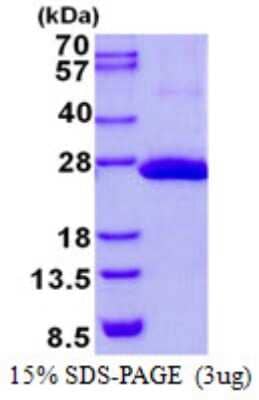 SDS-PAGE: Recombinant Human COMMD9 His Protein [NBP2-22795]