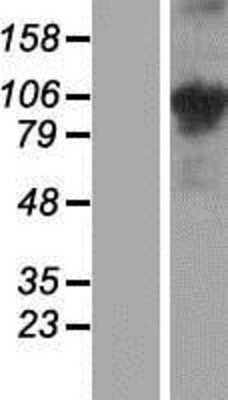 Western Blot: COMP/Thrombospondin-5 Overexpression Lysate [NBP2-09056]