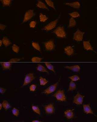 Immunocytochemistry/ Immunofluorescence: COMP/Thrombospondin-5 Antibody - BSA Free [NBP2-92733]