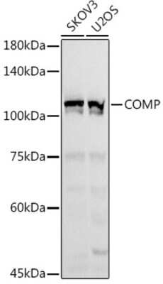 Western Blot: COMP/Thrombospondin-5 AntibodyAzide and BSA Free [NBP2-92658]