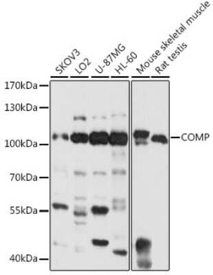 Western Blot: COMP/Thrombospondin-5 AntibodyBSA Free [NBP2-92733]