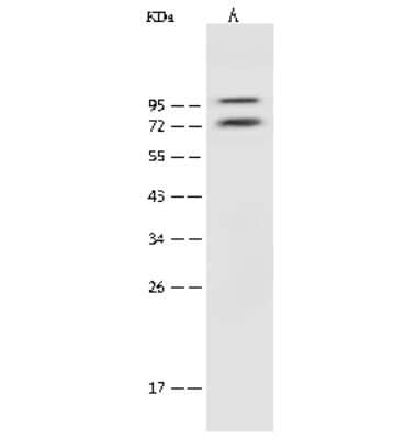 Western Blot: COMP/Thrombospondin-5 Antibody [NBP2-99528]