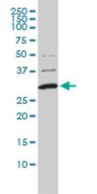 Western Blot: COMT Antibody (1G4-1A1) [H00001312-M01]