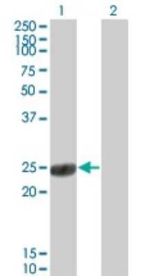 Western Blot: COMT Antibody (1G4-1A1) [H00001312-M01]