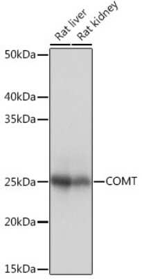 Western Blot: COMT Antibody (9Y2A3) [NBP3-16413]