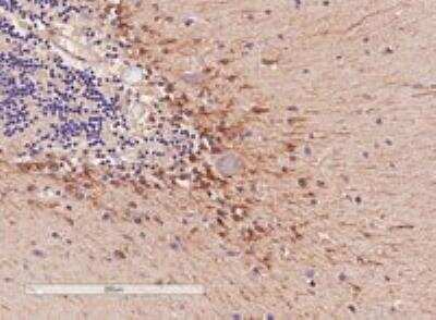 Immunohistochemistry-Paraffin: COMT Antibody [NB100-41387]
