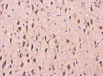 Immunohistochemistry-Paraffin: COMT Antibody [NBP2-15954]