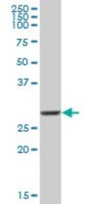 Western Blot: COMT Antibody [H00001312-B01P]