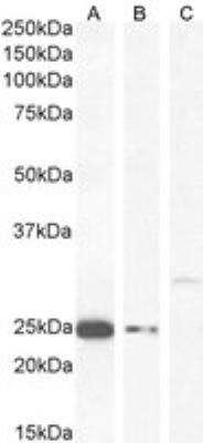 Western Blot: COMT Antibody [NB100-1780]