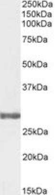 Western Blot: COMT Antibody [NB100-41387]