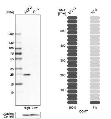 Western Blot: COMT Antibody [NBP1-85818]