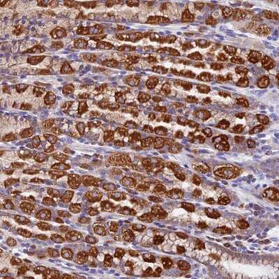Immunohistochemistry-Paraffin: COMTD1 Antibody [NBP1-82065]