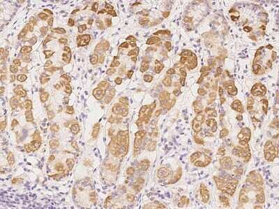 Immunohistochemistry-Paraffin: COMTD1 Antibody [NBP2-98181]