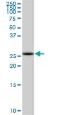 Western Blot: COMTD1 Antibody [H00118881-B01P]