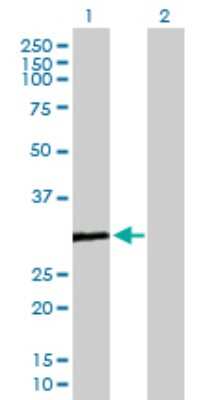 Western Blot: COMTD1 Antibody [H00118881-B01P]