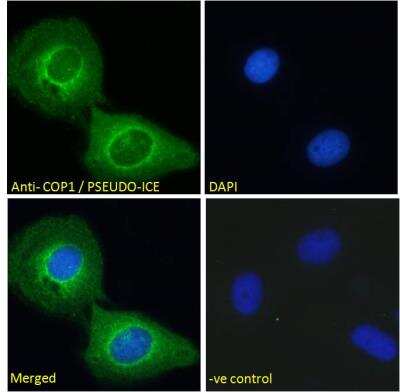 Immunocytochemistry/ Immunofluorescence: COP Antibody [NB100-856]