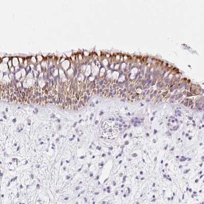 Immunohistochemistry-Paraffin: COP Antibody [NBP2-30778]