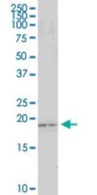 Western Blot: COP Antibody [H00114769-D01P]