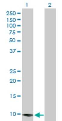 Western Blot: COP Antibody [H00114769-D01P]
