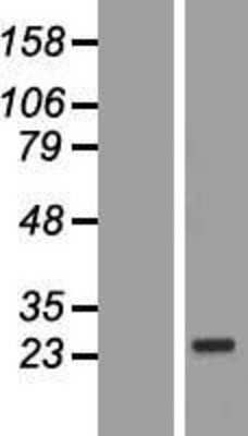 Western Blot: COP Overexpression Lysate [NBP2-11021]