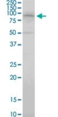 Western Blot: COP1 Antibody (1E4) [H00064326-M01]
