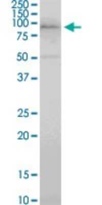 Western Blot: COP1 Antibody (1E4) [H00064326-M01]