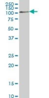 Western Blot: COP1 Antibody (1E4) [H00064326-M01]