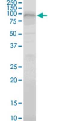 Western Blot: COP1 Antibody (1E4) [H00064326-M01]